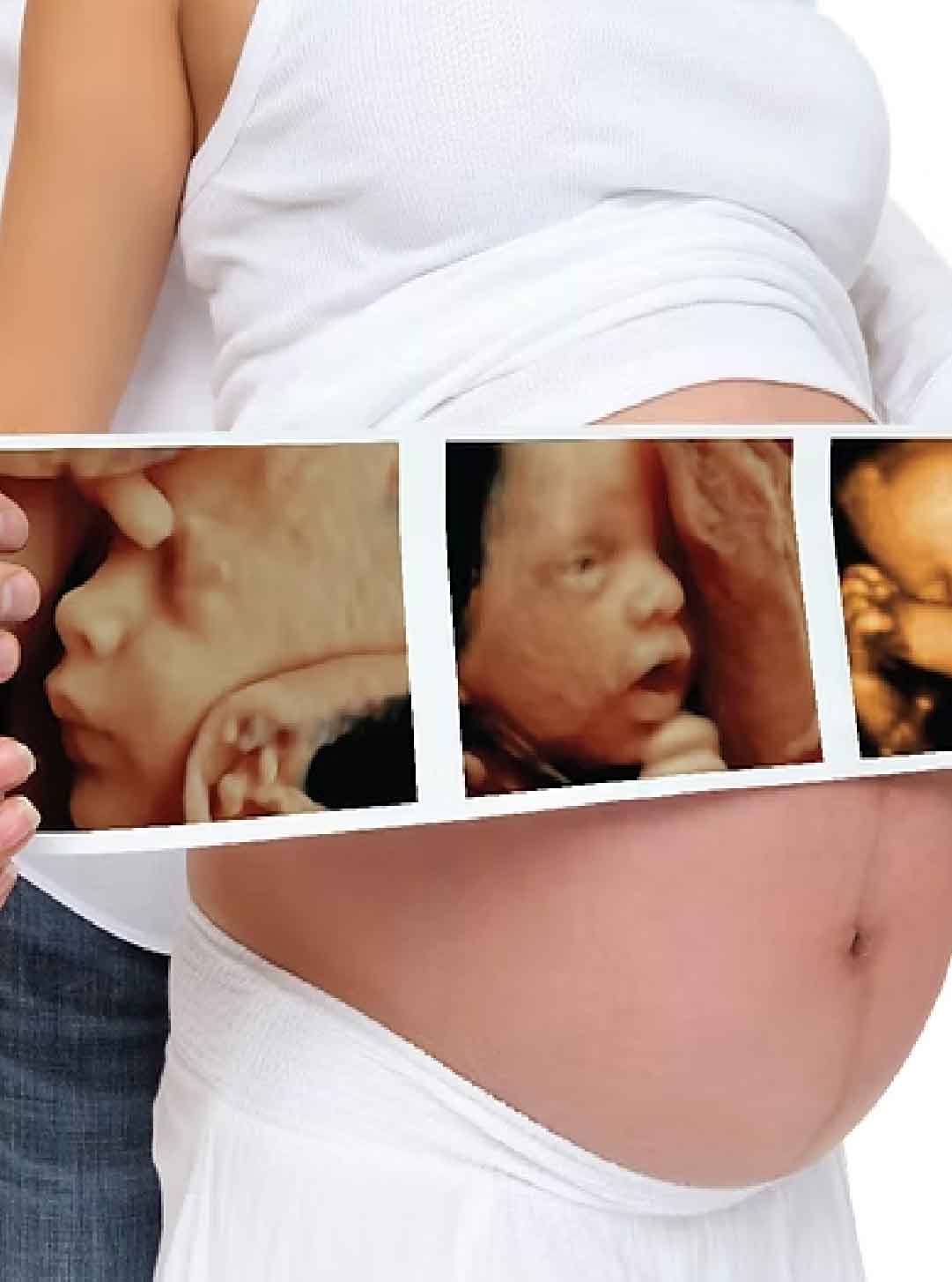 Doppler fetal